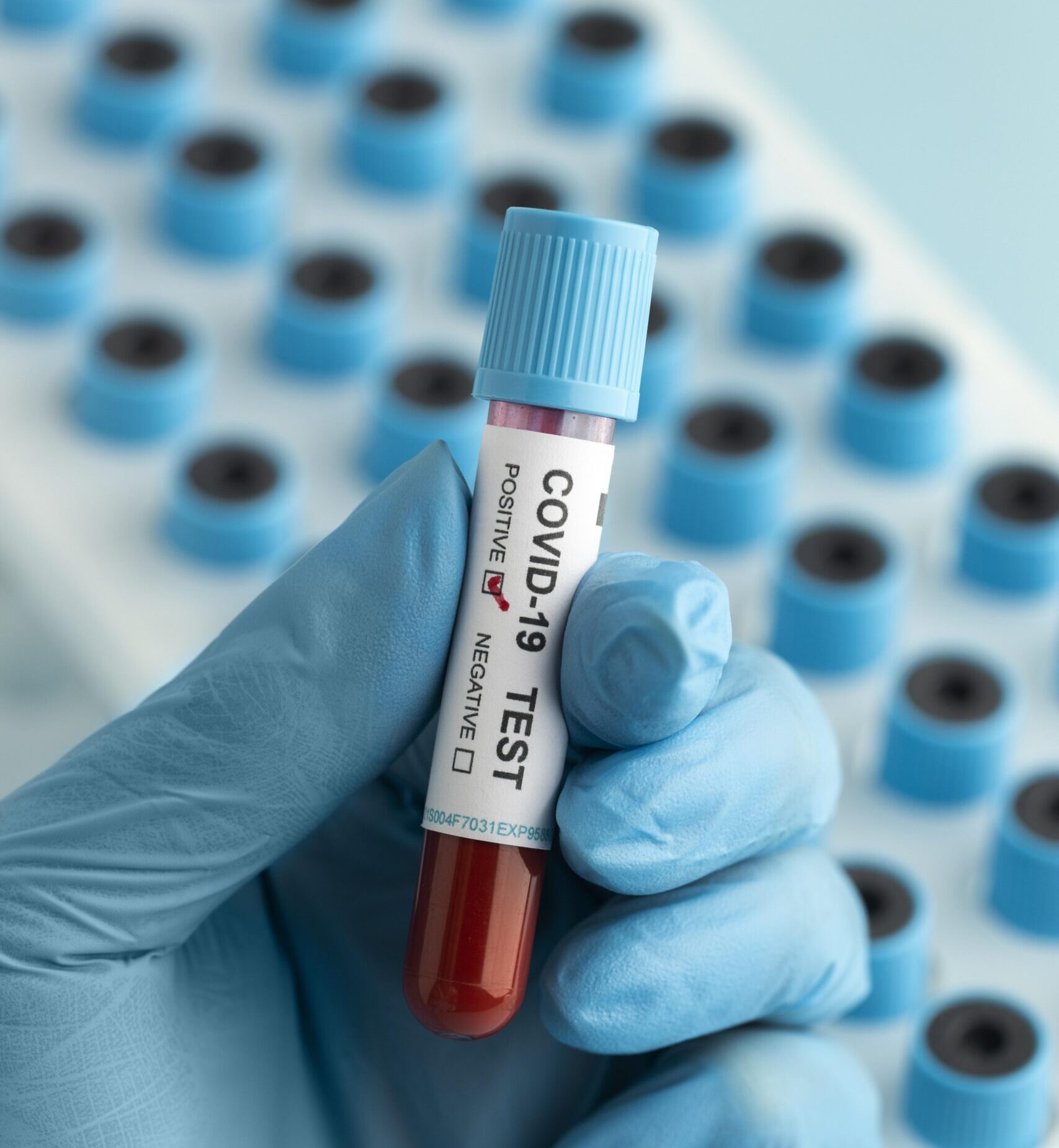 hand-with-protective-gloves-holding-blood-sample-covid-test