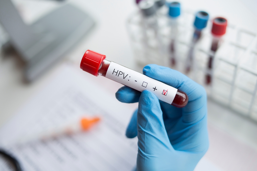 HPV Vaccination at home in Dubai, UAE