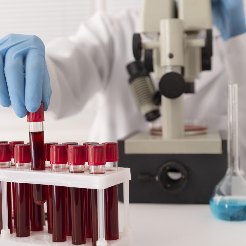 Essential Blood Test at Home in Dubai for Better Health